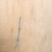 Mármol Rosa Portugués